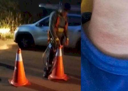 Adolescente enrosca pescoço em fios soltos e fratura coluna vertebral no Tiradentes (vídeo)