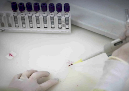 Secretaria de Saúde de SP investiga novo caso suspeito de ebola