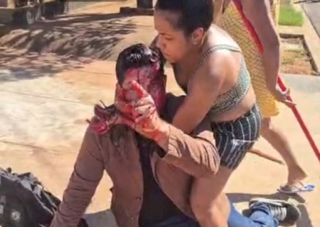 Jornalista é agredido por trio após deixar evento municipal em Três Lagoas
