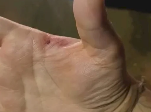 Corrida em carro de aplicativo acaba com motorista mordido pela passageira (Video)