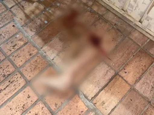 Mulher é atropelada e perna da vítima é encontrada a 50 metros do local do acidente