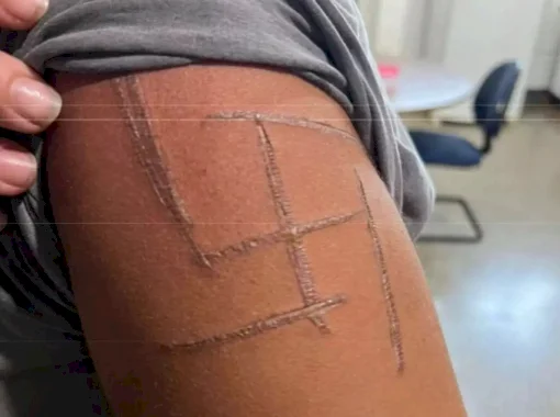 Justiça decreta prisão preventiva de trio acusado de marcar mulher trans com suástica