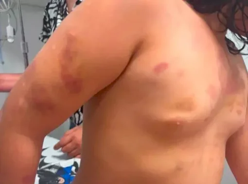 Menina brasileira é espancada pelo padrasto que acaba preso na fronteira