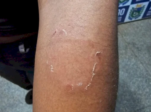 Após várias ligações, polícia prende homem que enforcou e mordeu mulher