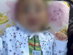 Bebê de 6 meses morre após apresentar hematoma na cabeça e sangramento no nariz