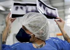 Câncer de pulmão: 15% dos casos acontecem em não fumantes