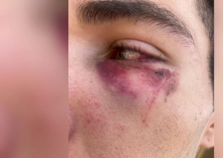 Em minutos, entregador é espancado e tem moto roubada no Pioneiros (vídeo)